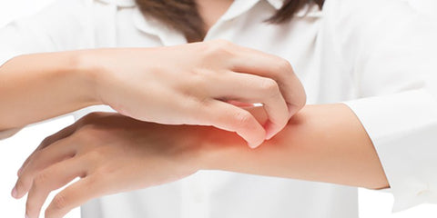 Eczema Remedies For Your Family